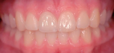 product-373-175 product-373-175