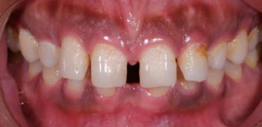 product-373-181 product-373-181